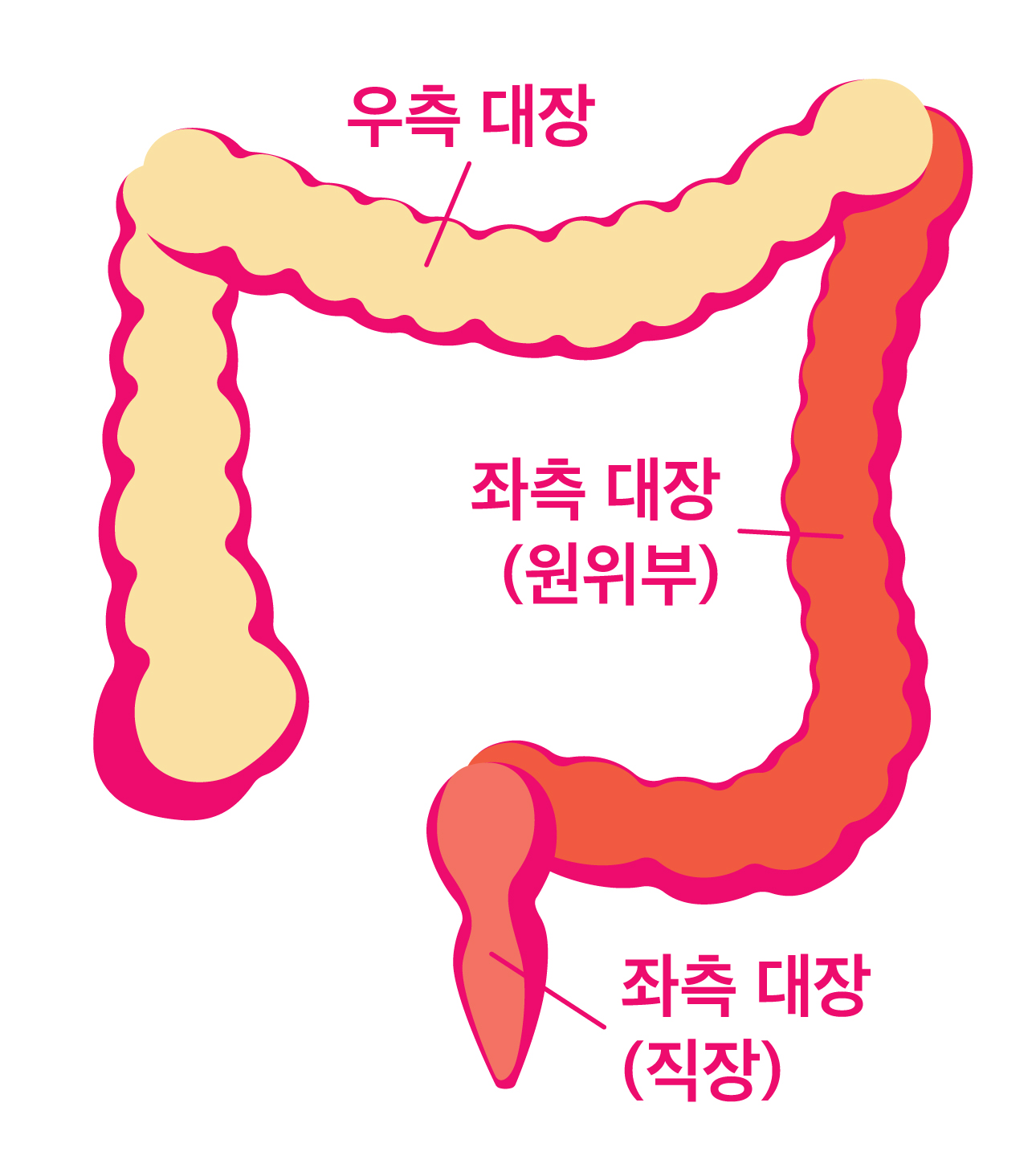 대장 대장
